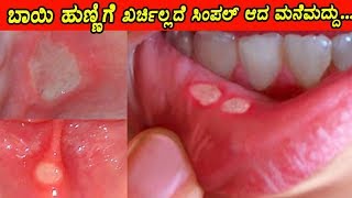 ಬಾಯಿ ಹುಣ್ಣು ಶಮನಕ್ಕೆ ಸಿಂಪಲ್‌ ಮನೆ ಮದ್ದು | Home Remedies to Heal Mouth |