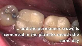 A patient's experience with high tech dentistry