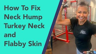 How To Fix Neck Hump, Turkey Neck and Flabby Skin