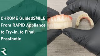 CHROME GuidedSMILE Full Arch Prosthesis Workflow: RAPID Appliance to Try-In, to Final Prosthetic