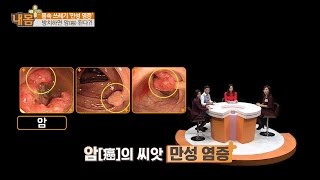 방치하면 암이 되는 만성 염증! [내 몸 플러스] 31회 20161106