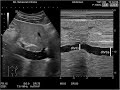 FLUID RESPONSIVENESS - DYNAMIC & STATIC MEASURES-                            DR PAVAN KUMAR VALA