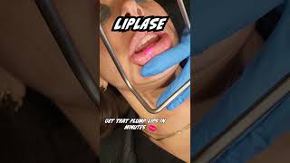 Want PLUMP and BEAUTIFUL lips quick? | LipLase for the perfect pout!