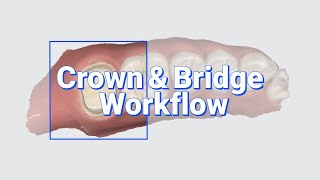 Crown & Bridge Workflow