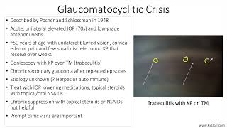 Lecture: Glaucomatocyclitic Crisis (1 Slide in 5 Minutes)