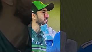 Agha Salman Struck Nasty Under Eye 😨 #aghasalman #aghasalmaninjury #cricket #asiacup2023 #shorts