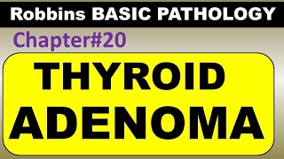 Ch20 | Thyroid Adenoma | Endocrine Pathology |Robbins Pathology | Dr Asif Lectures