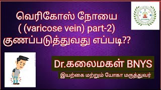 வெரிகோஸ் நோயை குணப்படுத்துவது எப்படி? PART-2 | VERICOSE VEIN | சுருள் சிரை நோய் | Dr Kalaimagal Ravi