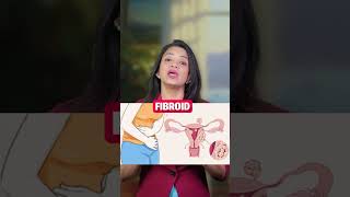 Early Pregnancy Miscarriage: Know the Signs | Dr. Sonal Parihar