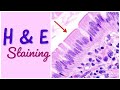 H & E staining || Hematoxylin & Eosin staining