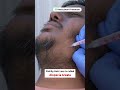 😍 Patchy Beard Treatment #shorts #shortsfeed #viral