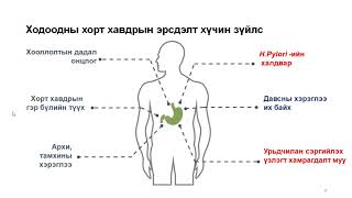 Ходоодны архаг үрэвслийн эрт илрүүлэг