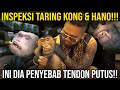 INSPEKSI TARING KONG & HANO!! INI DIA PENYEBAB TENDON KAKI PUTUS! #AudreyA #KINGOFTHEJUNGLE