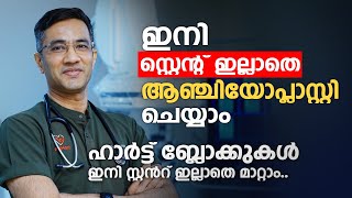 ഹാർട്ട് ബ്ലോക്കുകൾ ഇനി സ്റ്റൻറ് ഇല്ലാതെ മാറ്റാം | Medicated balloon | Dr. Jayesh Bhaskaran