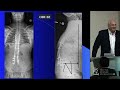 Current Concepts of Spinal Balance - Christopher I.  Shaffrey, MD