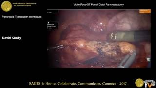 Pancreatic transection techniques