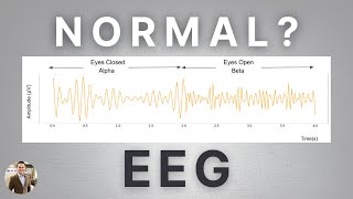 Alpha Brain Waves on EEG: What’s Normal and What’s Not?