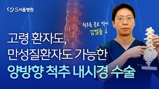 부담스러운 허리 수술, 양방향 내시경으로 부작용 줄이고 치료 효과 높인다