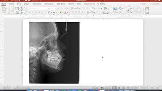 Using Powerpoint to draw ceph superimpositions