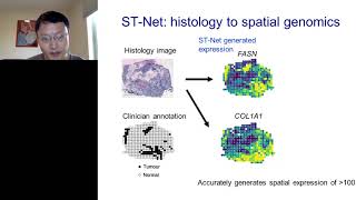 Deep learning to integrate histology with spatial transcriptomics