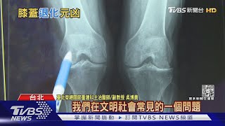 膝蓋退化...出現這「關鍵跡象」...醫師:若輕忽..後果難想像!｜十點不一樣20220305