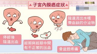 停經後異常出血要小心 【子宮內膜癌】