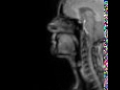 voiced uvular nasal mri