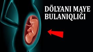 Dölyanı maye bulanıqlığı haqqında miflər - Mütləq baxın!