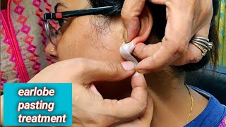 कान का छेद हमेशा के लिए छोटा करने का आसान तरीका/ear hole repair/ear hole closing without surgery