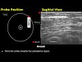 Breast Ultrasound Probe Positioning | Sagittal, Radial Views & Clock System USG Transducer Placement