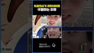 치과의사가 라미네이트 극혐하는 이유