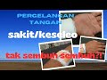 pergelangan tangan sakit,keseleo,terkilir,tak sembuh sembuh?!