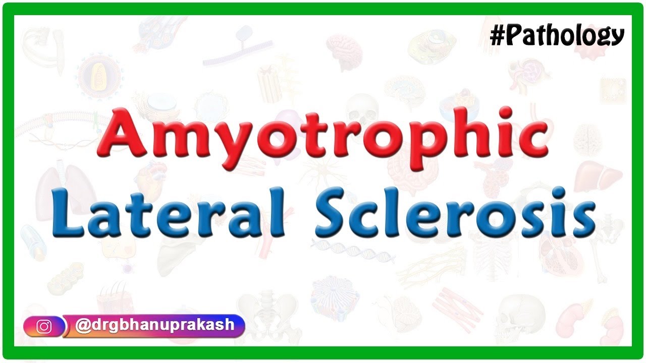 Amyotrophic Lateral Sclerosis: Etiology, Pathology, Clinical ...