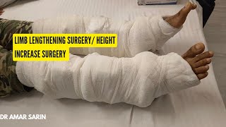 height Increase Surgery | Limb lengthening surgery | Dr Amar Sarin