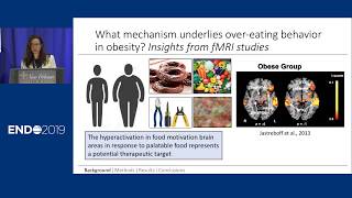 Obesity - ENDO 2019 Press Conference