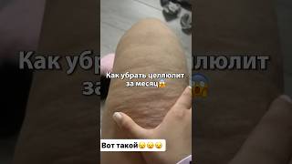 КАК УБРАТЬ ЦЕЛЛЮЛИТ ЗА МЕСЯЦ