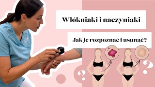 Włókniaki i naczyniaki – jak je rozpoznać i usunąć