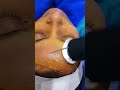 oxygeneomedifacial at kallambalam neobright