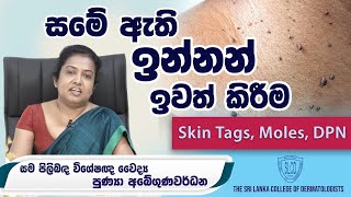 Warts, Skin Tags, Moles and DPN (සමේ ඇති ඉන්නන් ඉවත් කිරීම) : Dr. Punya Abeygunawardana #skincare