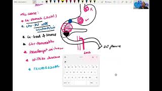 Gastric Outlet Obstruction- Clinical Approach for Final MBBS students