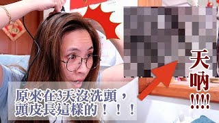 （潔癖慎入）原來三天沒洗頭的頭皮是這麼的。。。。。