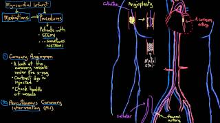 Khan Academy - Treatment of Myocardial Infarcts (Heart Attacks) with Interventions
