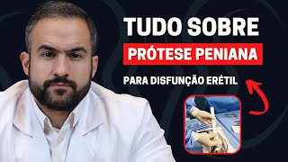 TUDO SOBRE PRÓTESE PENIANA: INDICAÇÕES, TIPOS, PÓS OPERATÓRIO E CUSTOS | DR. MATHEUS AMARAL