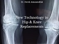 The Impact of New Technology on Hip & Knee Replacements | Dr. Derek Amanatullah