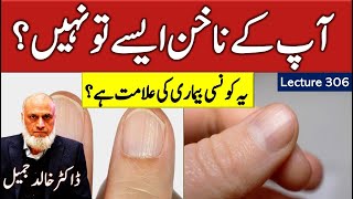 Nails important indicator of your health  | Lecture  306