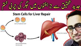 Reduce Your Liver Fat by 50 % in 2 Weeks - Dr Javaid Khan