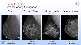 Dense Breast Consultation Clinic