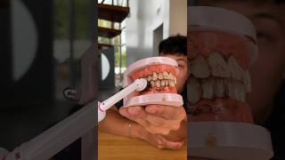 Testing Cheap Vs Expensive Toothbrushes