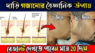 দাড়ি গজানোর উপায়- 😯 মাত্র ২০ দিনে।। Dari Gojanor Upay Bangla.