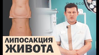 ЛИПОСАКЦИЯ ЖИВОТА 🔥 ВИБРАЦИОННАЯ ИЛИ УЛЬТРАЗВУКОВАЯ ЛИПОСАКЦИЯ❓